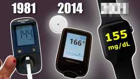 Non-Invasive Blood Sugar Monitor on Apple Watch?!