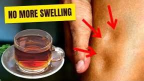 This Natural Remedy Will Reduce Your Swelling in Just 7 Days!