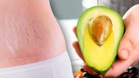 Say Goodbye to Stretch Marks With Avocado and Sunflower Oil
