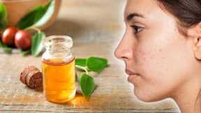 5 Benefits of Using Jojoba Oil For Your Face and Skin