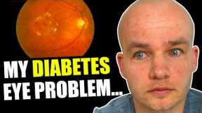This Happens to Your Eyes if Your Blood Sugar is High | My Diabetes Retinopathy Story
