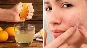 Say Goodbye to Pimples With This Cleansing Juice