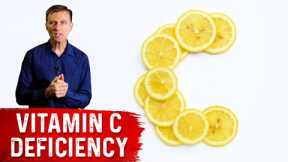 82 Percent of Covid-19 Patients Were Deficient in Vitamin C