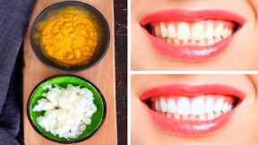 How to Whiten Teeth in a Few Days Using Only 2 Ingredients