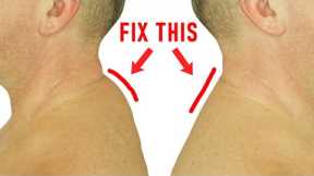 How to Get Rid of a Neck Hump at Home (Easy Method)