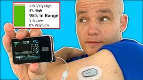 This Changed My Life with Diabetes | Control IQ Honest Review