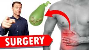 Gallbladder Surgery (Removal)? WATCH THIS!