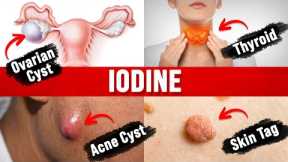 8 Unexpected Benefits of Iodine (MUST WATCH)