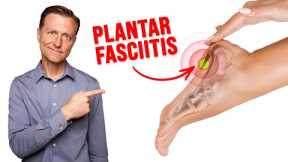 Fix Plantar Fasciitis Instantly (NO MORE HEEL PAIN!)