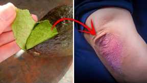Rub an Avocado Peel On Your Elbow For This Incredible Reason