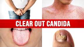 The ONLY Way to Cure Candida for Good
