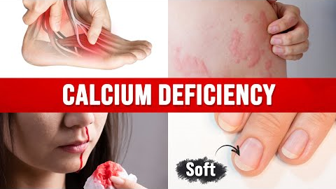 Best Home Test For A Calcium Deficiency