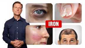 How Iron Affects Your Hair, Skin and Nails