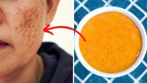 Miracle Carrot Mask to Get Rid of Melasma at Home