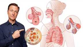 The BEST Remedy for Your Lungs (Infection, Asthma & COPD)