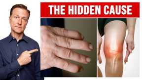 The Hidden Cause of Arthritis, Especially in Your Knees and Hands