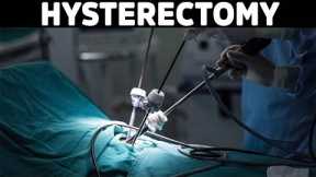 Think Twice before Getting a Hysterectomy