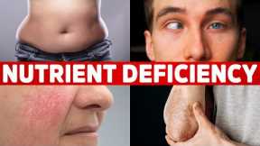 13 Signs Your Body is Deficient in Nutrients