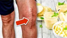 Avoid Knee Surgery with This Delicious Pineapple Smoothie Recipe