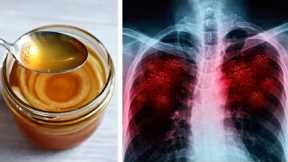 Homemade Syrup To Cleanse The Lungs, Stop The Flu And Persistent Cough
