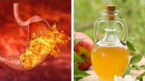Apple Cider Vinegar... For Heartburn? Does It Work?