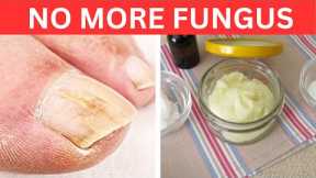 Garlic Paste: The Secret to Banishing Toenail Fungus for Good