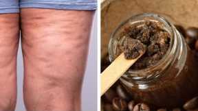 Get Rid of Cellulite and Stretch Marks with this Homemade Coffee Body Scrub!