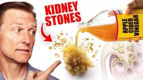 Use Apple Cider Vinegar to Dissolve Kidney Stones
