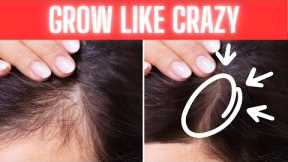 Grow Hair Like Crazy with This Rosemary Oil Trick