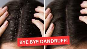Bye Bye Dandruff! Learn 4 Natural Tips for a Flake-Free Scalp!