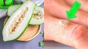 This Is How You Can Get Rid Of Warts For Good