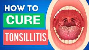 10 Home Remedies for Tonsillitis | Tonsillitis Treatments at Home