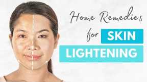 5 Home Remedies for Skin Whitening | Natural Remedies for Skin Ligthening