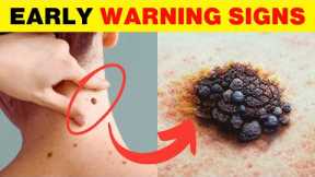 Visit Doctor Right Now if You Have These 12 Early Warning Signs of Cancer