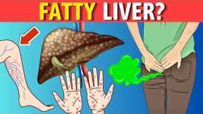 8 Signs That Indicate Your Liver Has Accumulated Fat