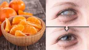 Most People Stop Using Eye Drops After Learning This About Tangerines