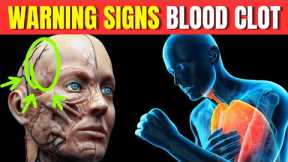 5 Seemingly Harmless Signs That Could Signal a Dangerous Blood Clot