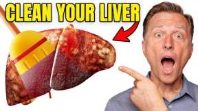 Top BEST Foods to Clean Out Your Liver