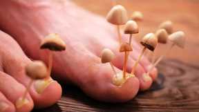 Never leave TOENAIL FUNGUS UNTREATED (Do This Instead!)