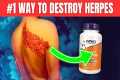 How to Destroy Herpes Fast and