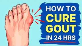 How to Heal Gout Naturally (Results in 24 hours!)