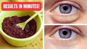 Tired of Looking Tired? This Trick Will Erase Your Under-Eye Bags in Minutes!