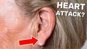 Do You Have This Line on Your Earlobe? You Might Be at Risk