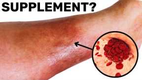 One Tablespoon a Day and Blood Clots Disappear Forever!