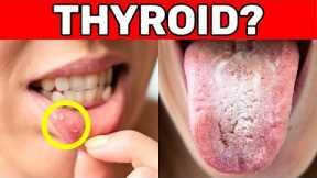 This in your mouth? Your thyroid's screaming for help!