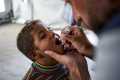 Polio Vaccination Drive Begins in